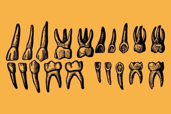 Twenty Temporary Teeth poster, Horizontal Dental Clinic Wall Decor framed canvas wall art